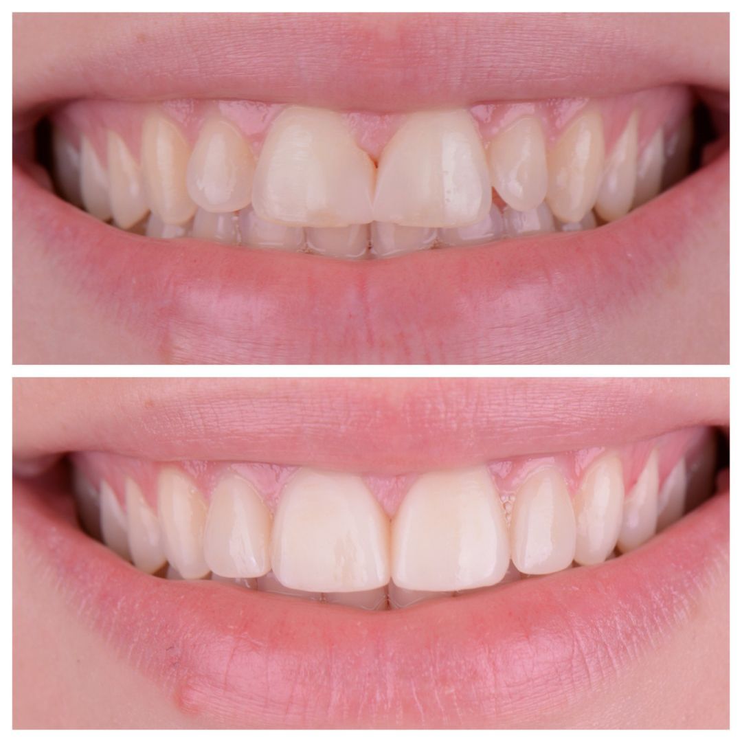 Cosmetic dental patient testimonials